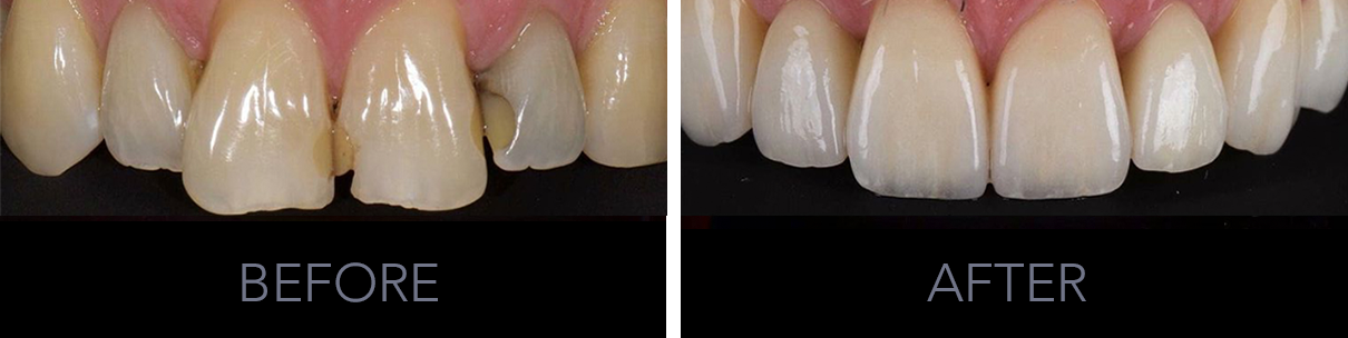 Before & After 6