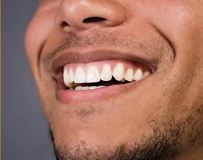 Young man smiling with bright white fillings