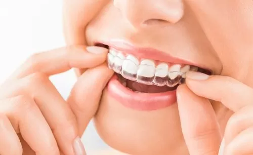 Woman inserting Invisalign retainer for Hamilton Orthodontics