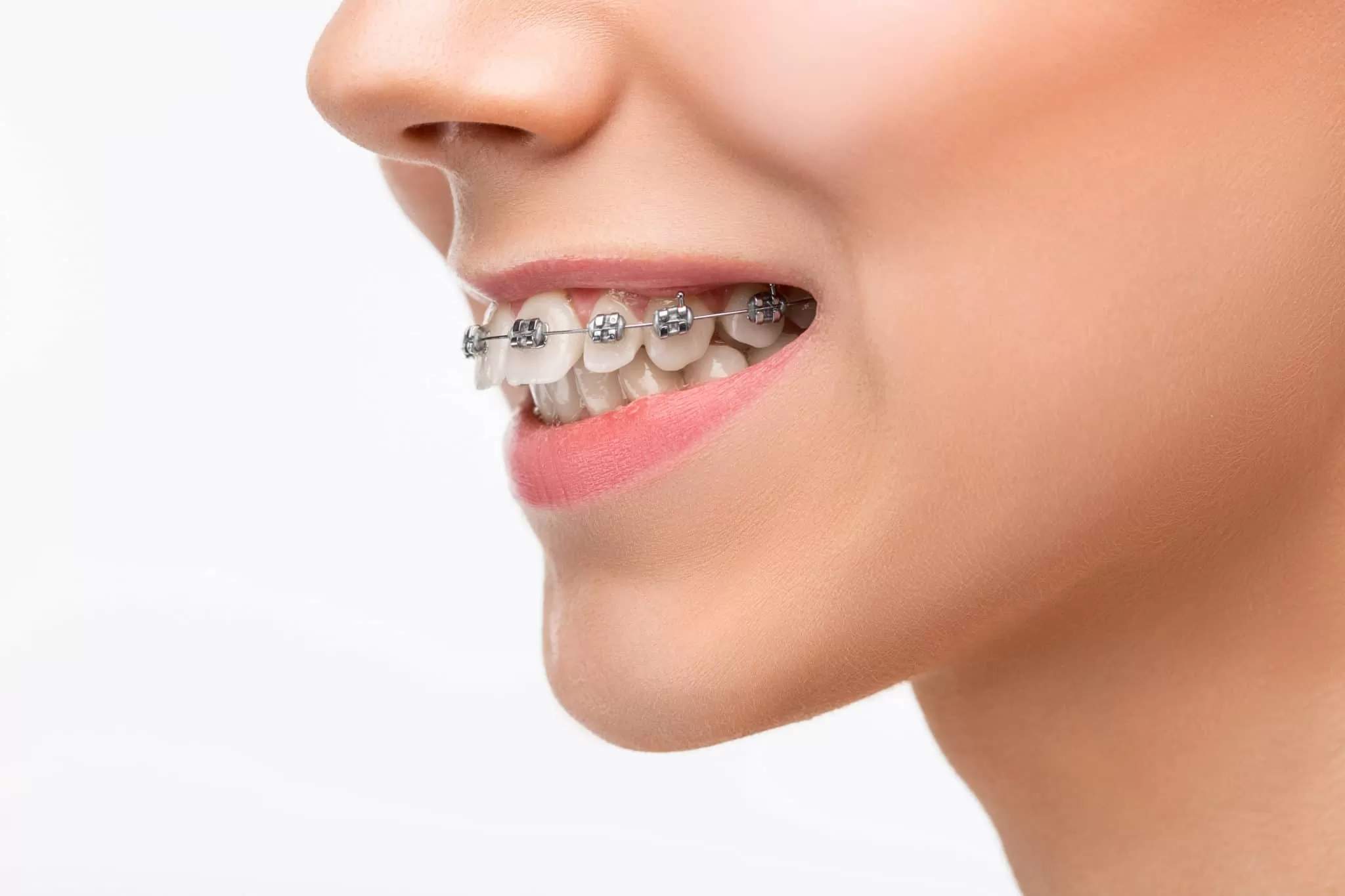 Orthodontics 8